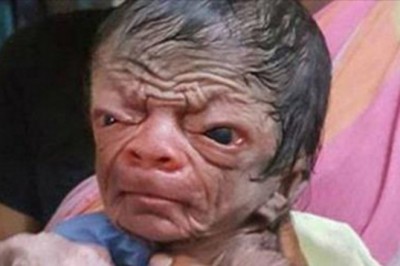 Mama z przerażeniem spogląda na twarz nowo narodzonego dziecka! Mimo diagnozy miłość zwycięża!