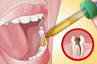 Poznaj naturalną metodę na pozbycie się ostrego bólu zęba! Nawet mój dentysta był zaskoczony!