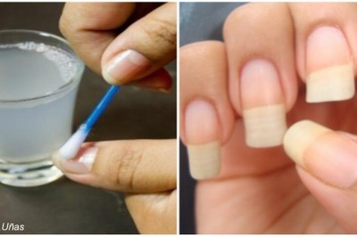 Dzięki tym składnikom Twoje paznokcie będą rosły zdecydowanie szybciej i będą mniej łamliwe!