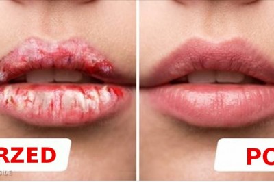 Dzięki tej prostej metodzie uzyskała jędrne i różowe usta, a skórki zniknęły! Sprawdź sama jak prosto!