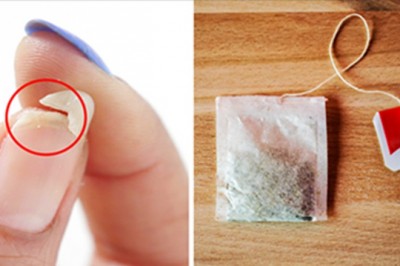 Złamany paznokieć możesz uratować przy pomocy zwykłej torebki do herbaty! Zobacz jak to zrobić!