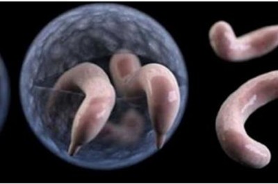 Ta choroba jest nieuleczalna, a z łatwością można się nią zarazić na basenie! Zobacz na co uważać! 