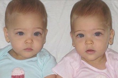 Gdy się urodziły w 2010 roku okrzyknięto je najpiękniejszymi bliźniaczkami świata! Zobacz jak wyglądają dzisiaj!