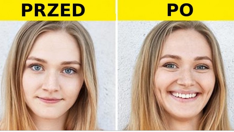Poznaj nietypowe operacje plastyczne, które stały się bardzo modne wśród bogaczy! Zrobiłabyś to?