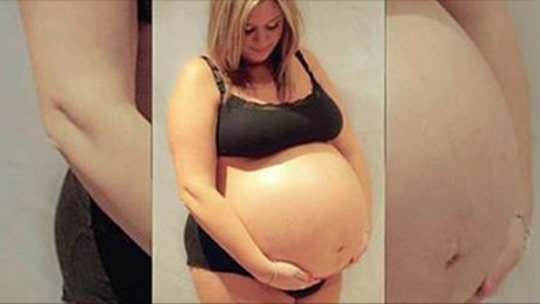 Jej brzuch już w 12 tygodniu ciąży był ogromny i nie przestawał rosnąć! Przytyła ponad 40 kg!
