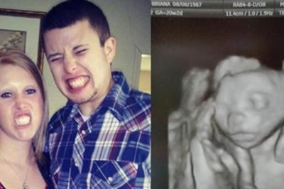 Zdecydowała się na terapię hormonalną, żeby zajść w ciążę! Podczas USG lekarz widzi coś zaskakującego!