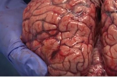 Neurobiolog pokazał jak wygląda świeżo wyjęty z czaszki ludzki mózg! Zaskakujące jak bardzo jest delikatny!