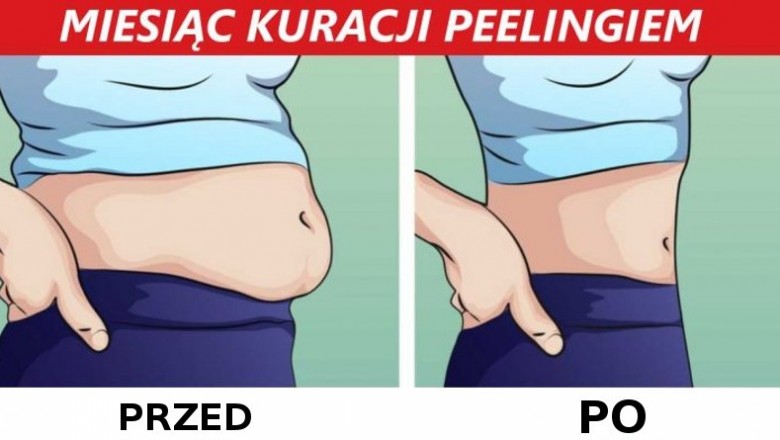 Nazywają to „wewnętrzny peeling jelit”! Dzięki temu zabiegowi możesz zrzucić nawet 4 kg!
