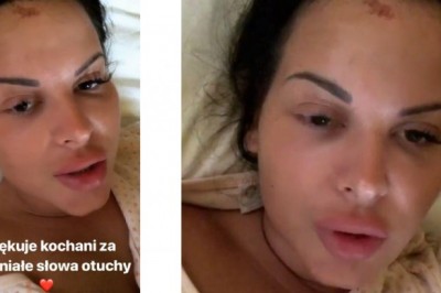 „Żałuję tego, co się stało” Esmeralda pokazuje zdjęcia ze szpitala i opowiada o wypadku!