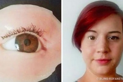 20 osób, które nie bały się pokazać swojej odmienności. Ciężko uwierzyć, że można mieć takie dłonie