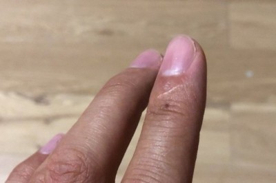 6 osobliwych cech i znaków szczególnych, które posiada 99% ludzi. Sprawdź czy jesteś wyjątkiem