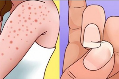 9 objawów wskazujących na to, że nie tolerujesz glutenu. Zobacz kiedy należy go unikać