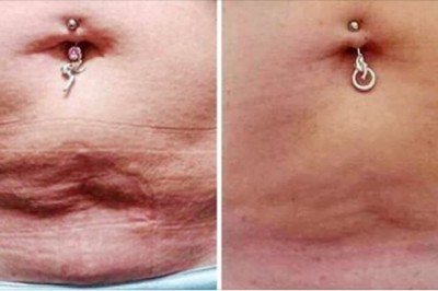 8 efektywnych sposobów na pozbycie się tłuszczu i ukształtowanie mięśni brzucha. Naprawdę możesz to osiągnąć