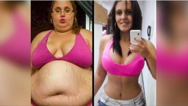 13 osób, które podjęły walkę ze swoją otyłością i wyszły z niej zwycięsko. Super inspirujące
