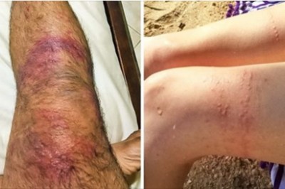 10 nietypowych zastosowań „wody ognistej” o których nie wie większość z nas. Nadaje się nie tylko do picia,