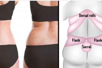 7 skutecznych ćwiczeń na pozbycie się tłuszczu z pleców. Wyglądaj lepiej i czuj się zdrowasza 