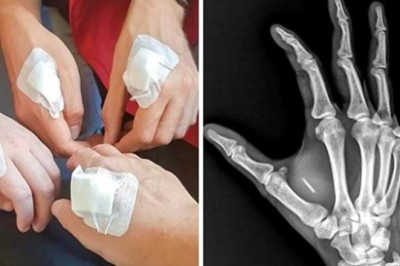 Obywatele Szwecji wszczepiają w swoje dłonie cybernetyczne ulepszenia. Czy jest się czego obawiać?