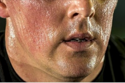 8 znaków świadczących o tym, że twój organizm desperacko potrzebuje witaminy D. Lepiej ich nie lekceważ 