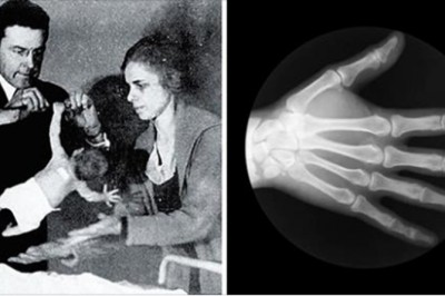 10 nietypowych faktów, które pokazują, że nasze ciało jest pełne tajemnic