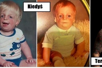 Po urodzeniu rodzice porzucają go z powodu wad genetycznych. Ciężko uwierzyć jak potoczyło się jego życie