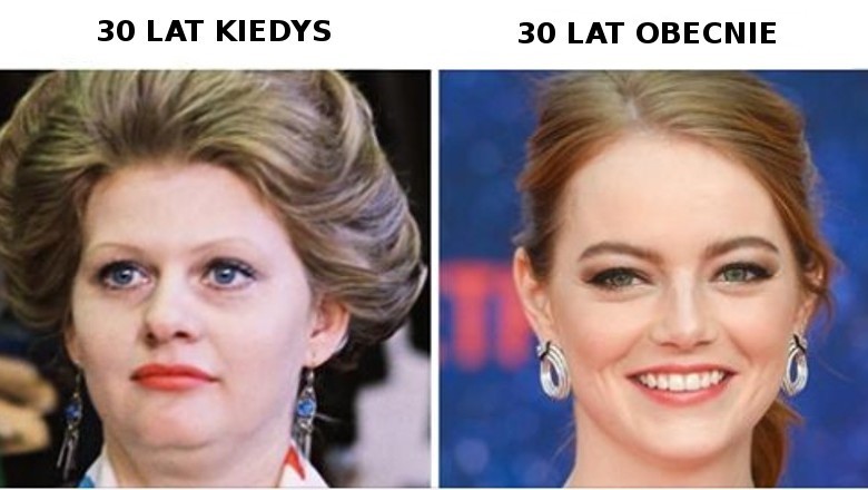 Oto dlaczego 30-letnie kobiety wyglądają w dzisiejszych czasach młodziej niż w przeszłości. Zobacz co się zmieniło