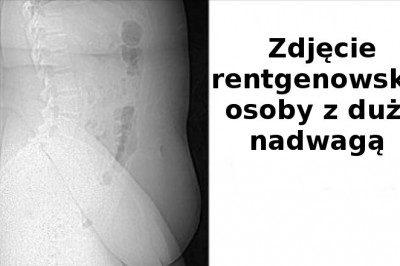 15 niezwykłych zdjęć ludzkiego ciała, których nie zobaczysz każdego dnia