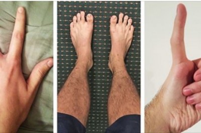 Ludzie dzielą się zdjęciami swoich niezwykłych części ciała. W niektóre z nich ciężko uwierzyć 