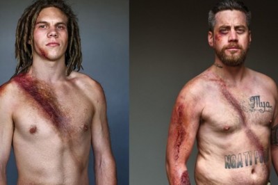 Tym ludziom zapięcie pasów uratowało życie. Zobacz jak wielkie ślady zostają na ciele