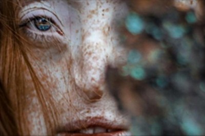 Jak miała 16 lat musiała przejść ciężką operację. Zdjęcie jej odkrytego ciała odbiera mowę