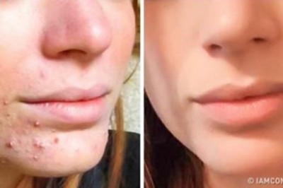 5 skutecznych porad, które pomogą ci w pielęgnacji skóry. Zobacz jak uzyskać gładką cerę w domu