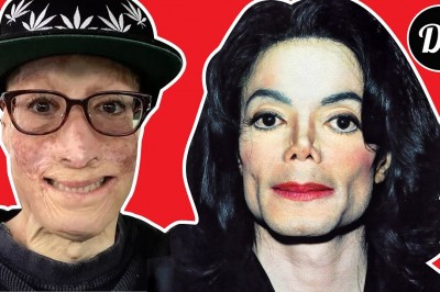 Michael Jackson i jego podpalony przez ojca przyjaciel, Dave Dave!