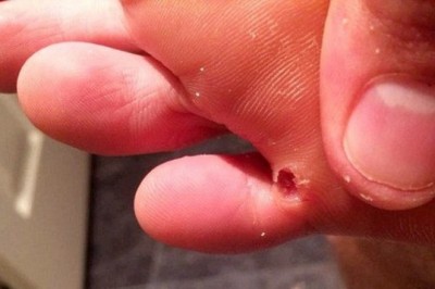 Jeśli zauważasz u siebie te objawy, to prawdopodobnie w twoim organizmie zagnieździły się pasożyty