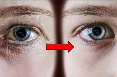 7 łatwych ćwiczeń przeciwzmarszczkowych, które zauważalnie odmłodzą twoją twarz. Koniec z wiotką skórą 