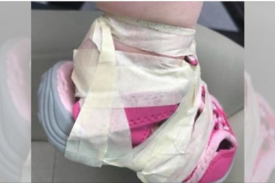 Przedszkolanki przykleiły taśmą buciki do stóp jej córki. Półtoraroczna dziewczynka miała siniaki