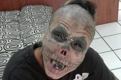Usunął sobie uszy i nos żeby wyglądać jak ludzka czaszka. Twierdzi, że dopiero teraz jest szczęśliwy