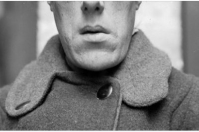 Uznano ją za najbrzydszą kobietę na świecie. Całe życie była obiektem kpin 