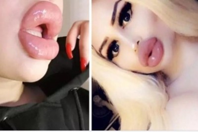 19 dziewczyn, które twierdzą, że ich usta są ciągle za małe. Planują wypełnić je bardziej