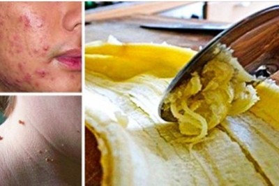 8 powszechnych błędów podczas pielęgnacji skóry, które szkodzą twojej twarzy