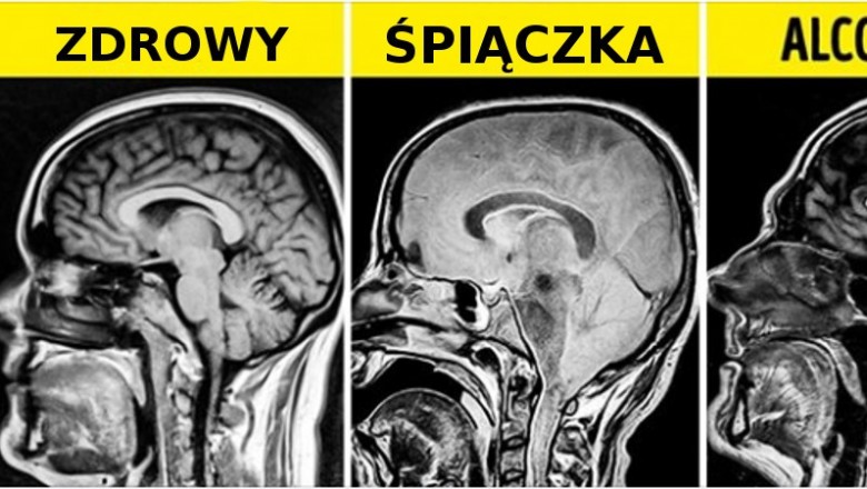 16 zdjęć rentgenowskich, które powiedzą o ludzkim ciele więcej niż książki do anatomii