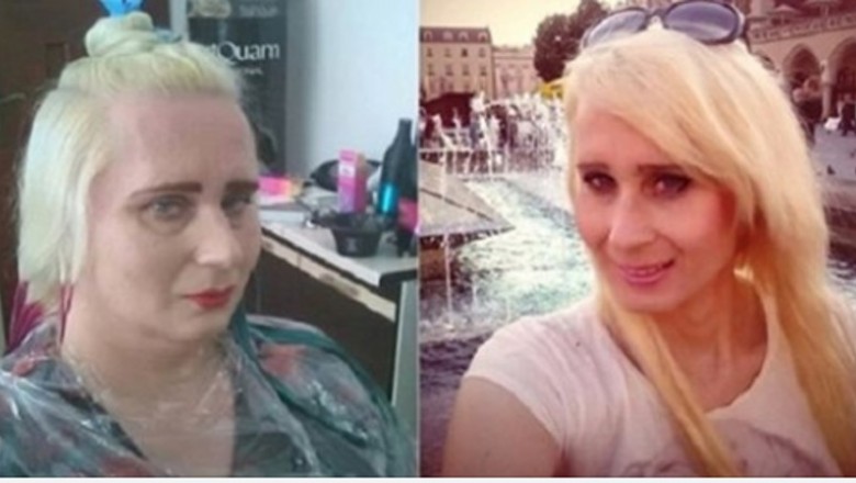 Alex z Chłopaków do Wzięcia znów poprawiała swój wygląd. Odwiedziła salon medycyny estetycznej