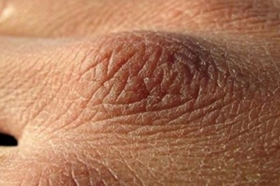 Możesz spożywać za mało płynów? Poznaj 8 objawów, że pijesz za mało wody