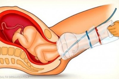 21 nietypowych rzeczy, które stworzono by ułatwiać nam życie. O wielu nie miałaś pojęcia