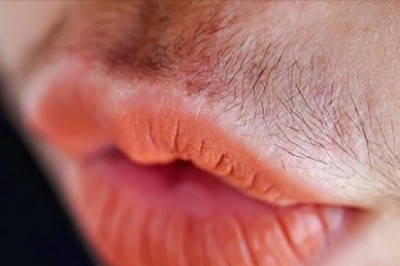 Przeczytaj co nadmierne owłosienie określonych partii ciała mówi o zdrowiu kobiety