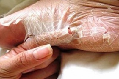 8 niezwykłych rzeczy jakie potrafi zrobić Twoje ciało. O większości ludzie nie mają pojęcia