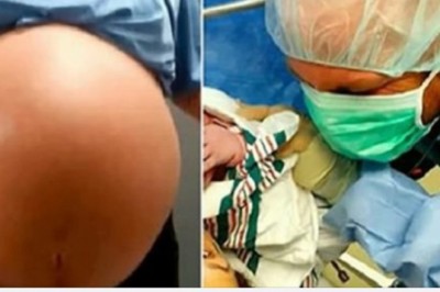 Słyszy jak lekarz i pielęgniarki krzyczą podczas porodu. Po chwili widzi dziecko