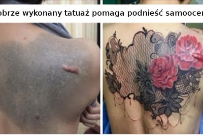 18 osób, które zdecydowały się ukryć swoje niedoskonałości za pięknymi tatuażami