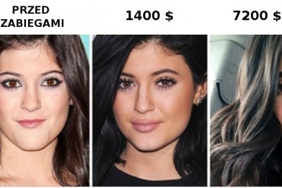 Ile kosztuje „twarz instagramowej modelki”, i przeprowadzenia jakich operacji wymaga