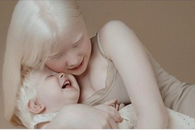 Siostry-albinoski urodzone w odstępie 12 lat oczarowały internet swoimi fotografiami