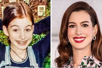 Sławne piękności, które przemieniły się z brzydkich kaczątek w idolki dla milionów