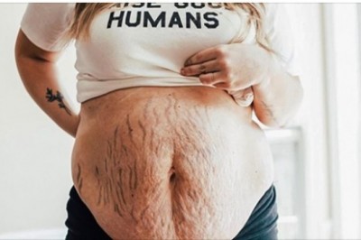 Galeria odważnych kobiet, które nie wstydzą się pokazać swojego ciała po ciąży